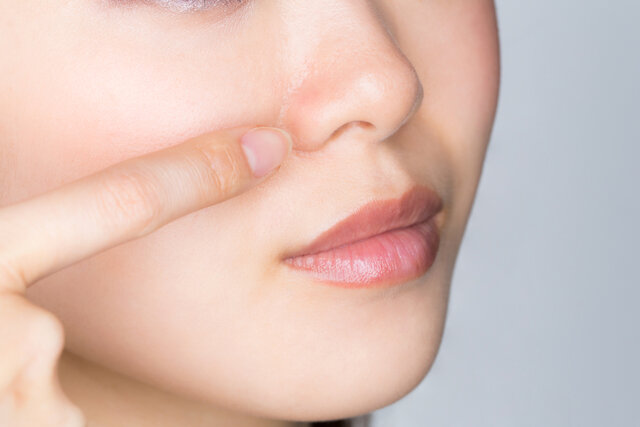 鼻にできた茶色いシミを薄くするには？種類や原因、色による違いを解説
