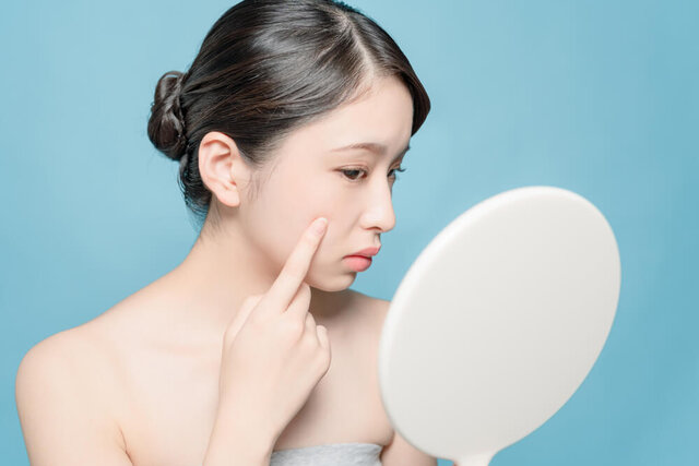 できてしまった頬のシミ…代表的なシミの種類や原因・効果的な対処法を紹介