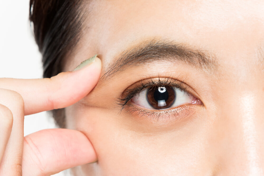目の周りの色素沈着はどうすれば薄くなる？原因と対策を分かりやすく解説